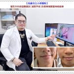 小港醫院整形外科徐詣醫師談減壓手術改善車禍顏面神經麻痺＠全球華僑報